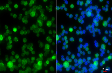 Anti-Syk antibody [HL4248] used in Immunocytochemistry/ Immunofluorescence (ICC/IF). GTX643081